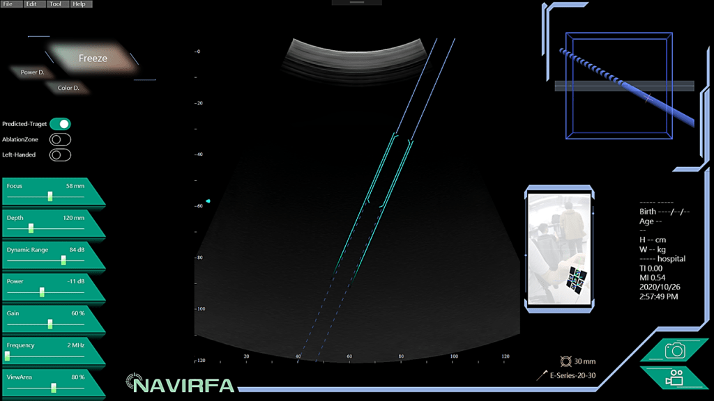 NAVIRFA® Guidence Software