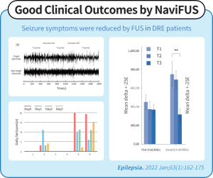 NaviFUS® Neuromodulation for Epilepsy Therapy