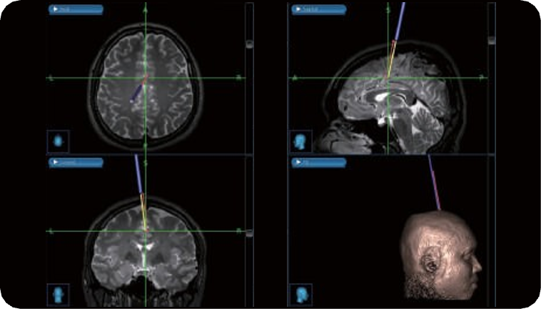 FUS Focal Point Guidance