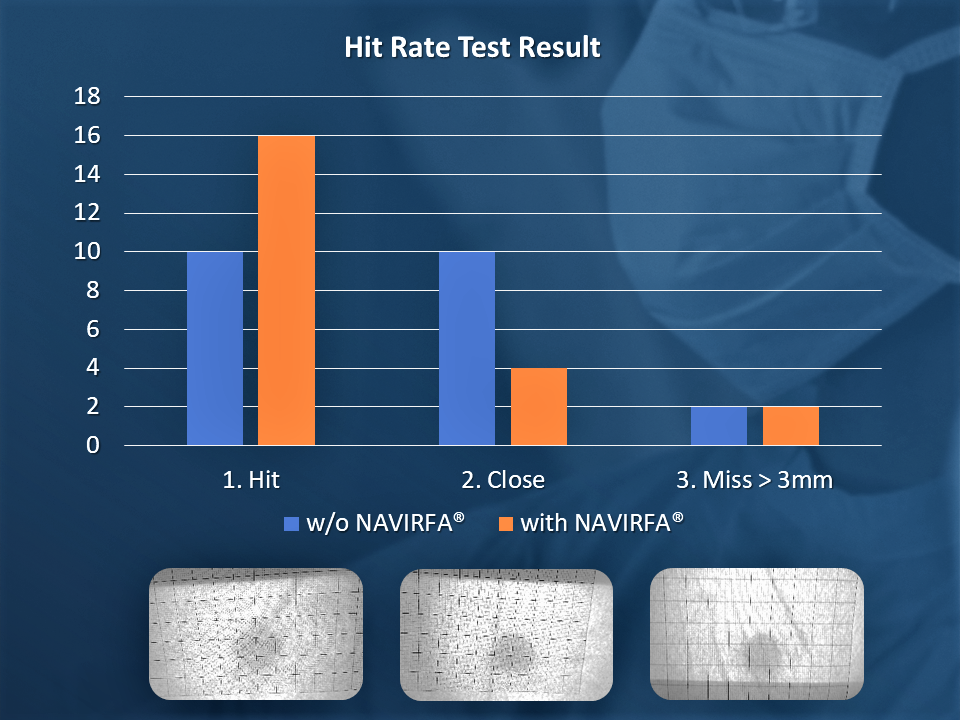 The test results show using NAVIRFA® Needle Tracking System increases the hit rate to 60%!